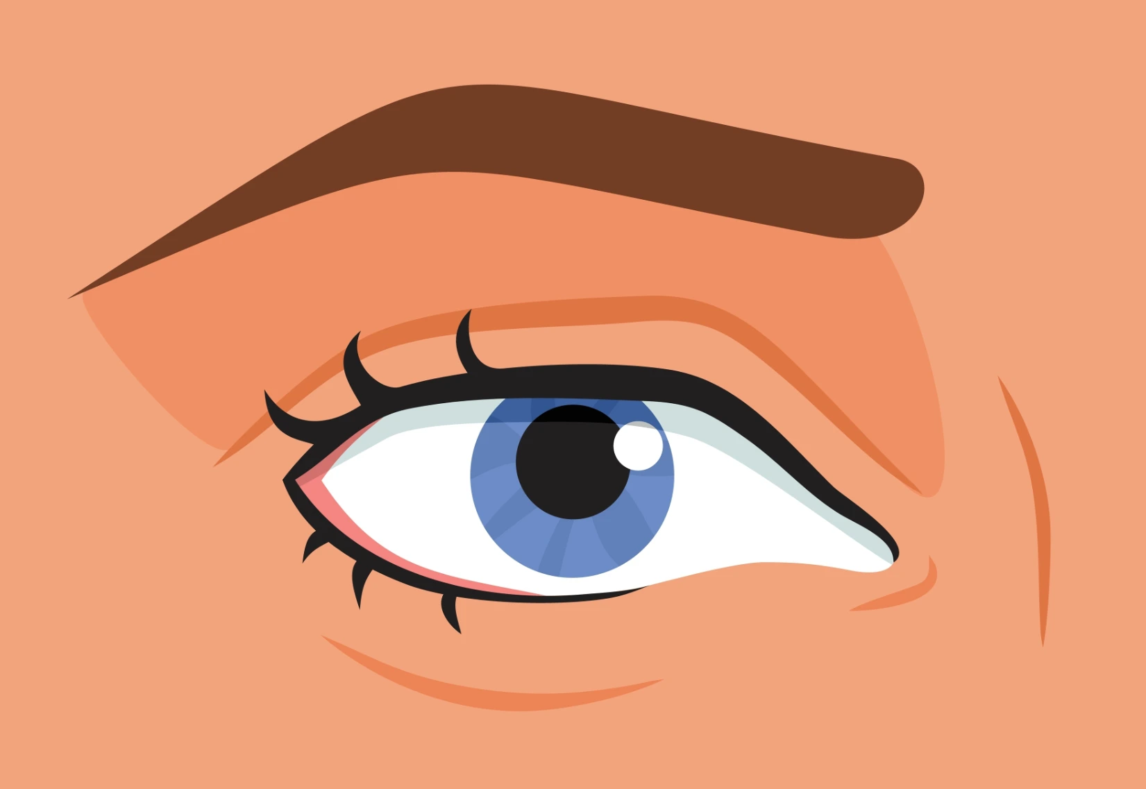 Blépharoplastie — illustration 2