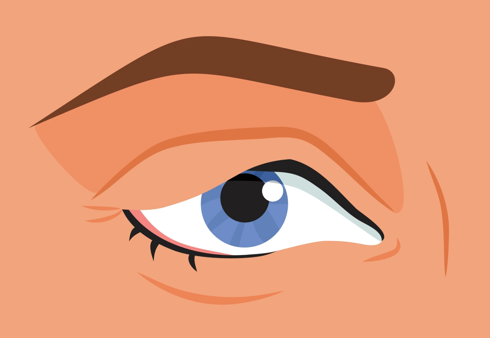Blépharoplastie — illustration