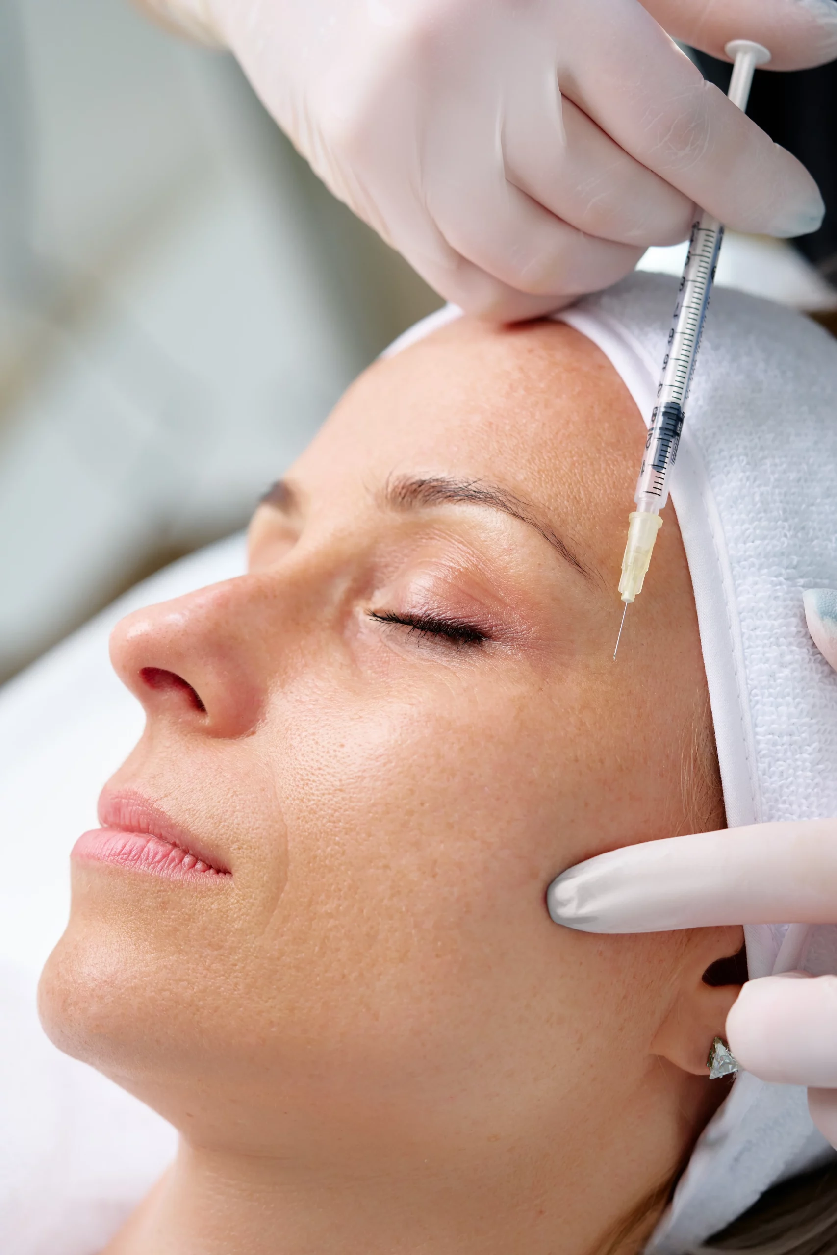 Injections de Botox (lifting médical du regard) — illustration